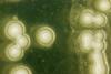Yeast under the microscope
