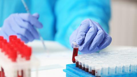 Scientist working with blood sample in a laboratory 